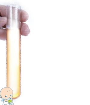 无精症成功案例
